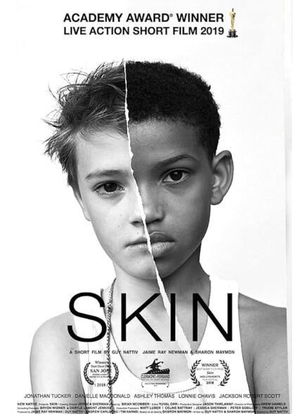 دانلود فیلم پوست | Skin